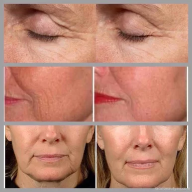 Perfect Skin Laser Clinic, Melbourne - Photo 1
