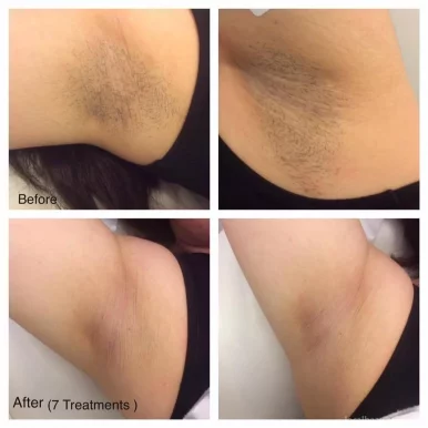 Perfect Skin Laser Clinic, Melbourne - Photo 2