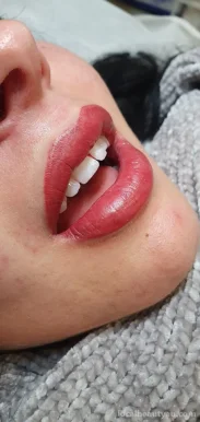 Velvet Lips Cosmetic & Medical Tattoo, Melbourne - Photo 2