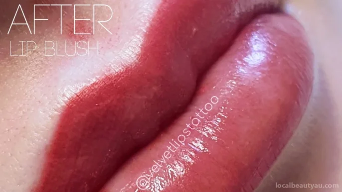 Velvet Lips Cosmetic & Medical Tattoo, Melbourne - Photo 1