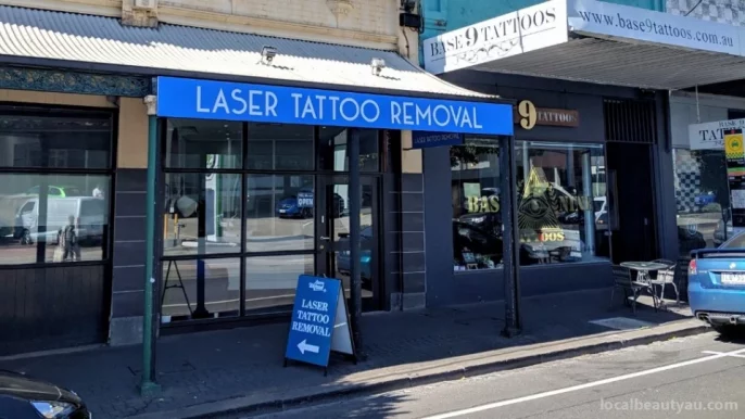 Lazer Wizard Tattoo Removal, Melbourne - Photo 3